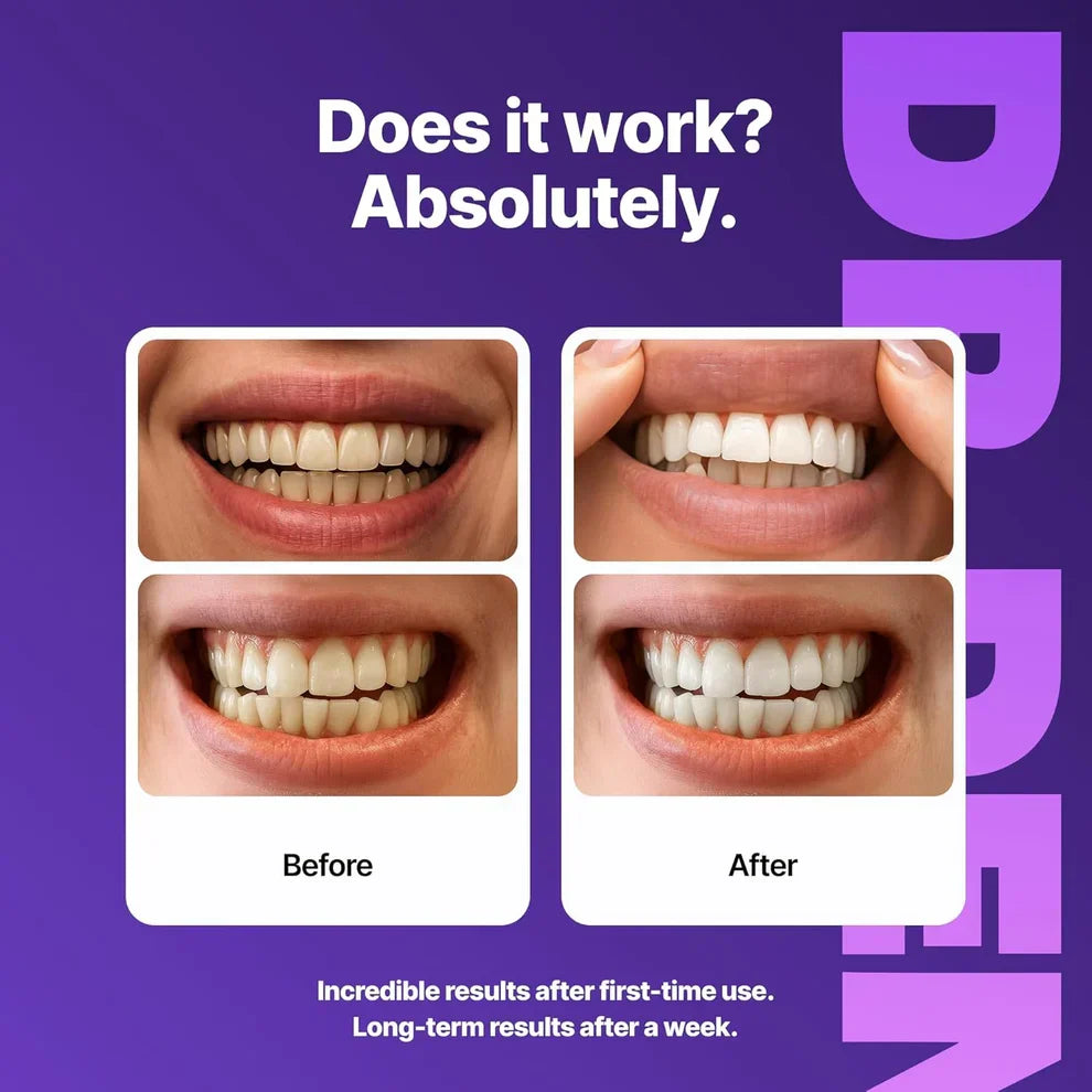 SmileLuxe™ Purple Sensitive Whitening 42 Strips